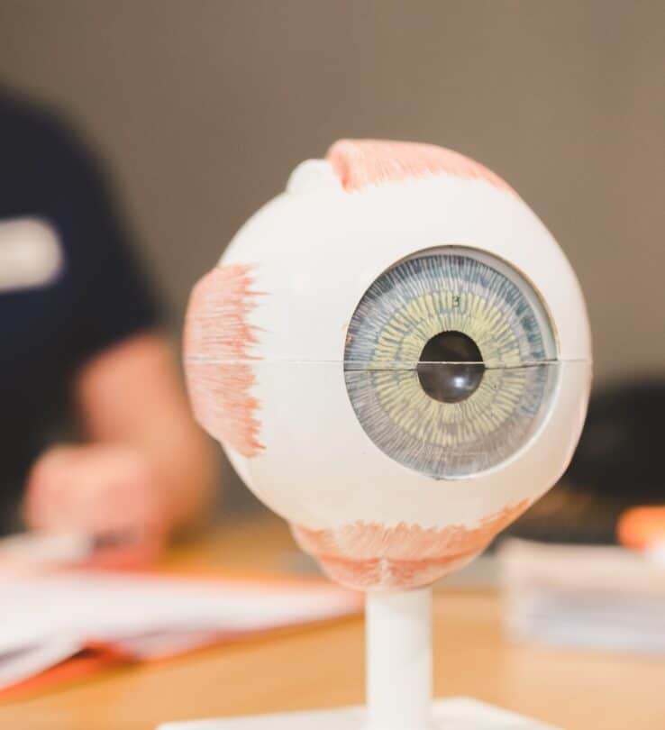 Statue of an eye in relation to Vitreoretinal Surgery Sapphire Eye Care