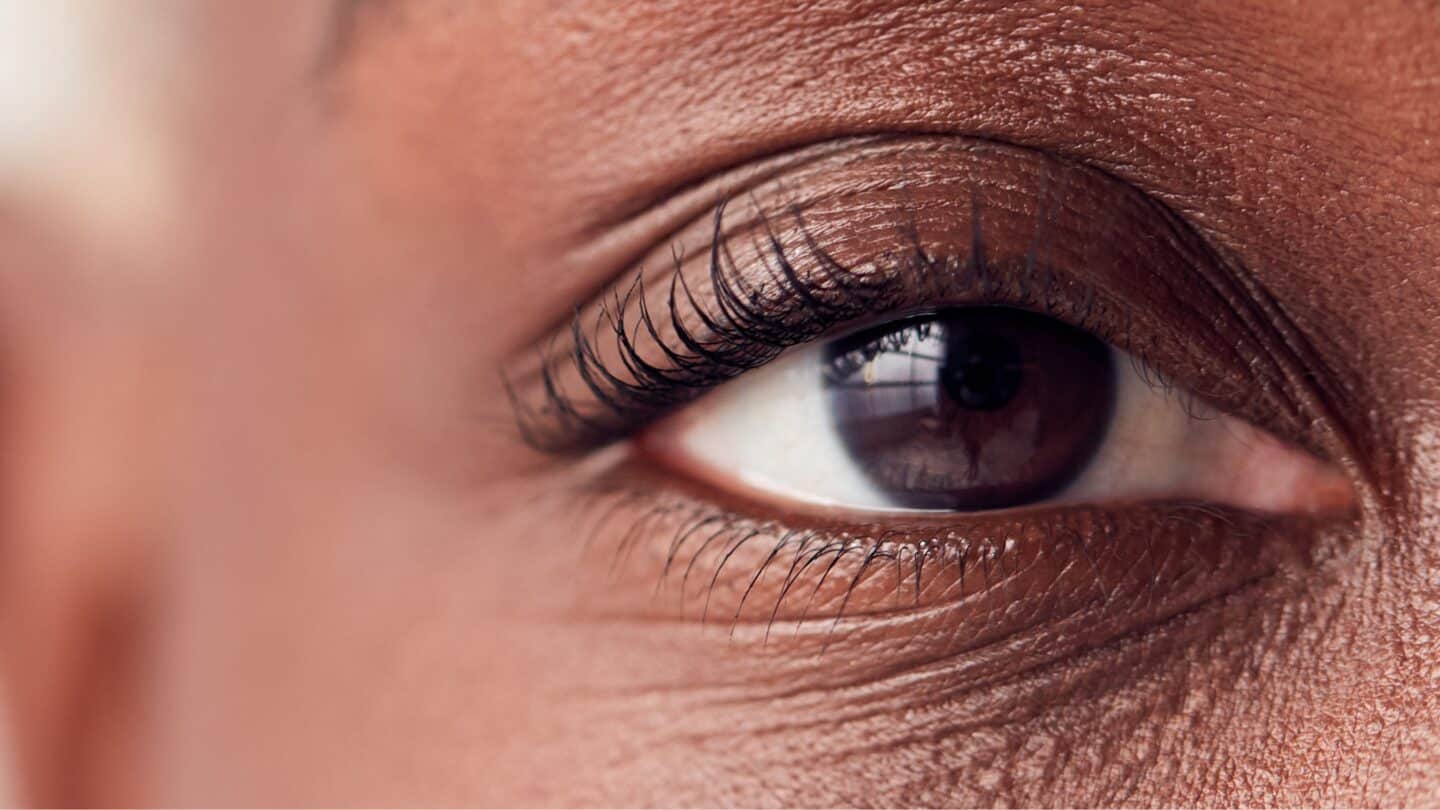 Eye and iris relating to Vitreous Haemorrhage at Sapphire Eye Care