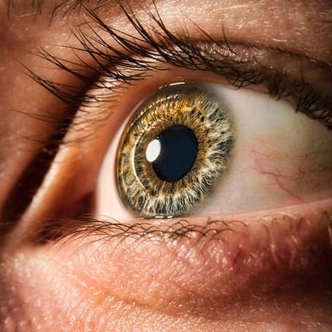 Eye and iris relating to Vitreous Haemorrhage at Sapphire Eye Care