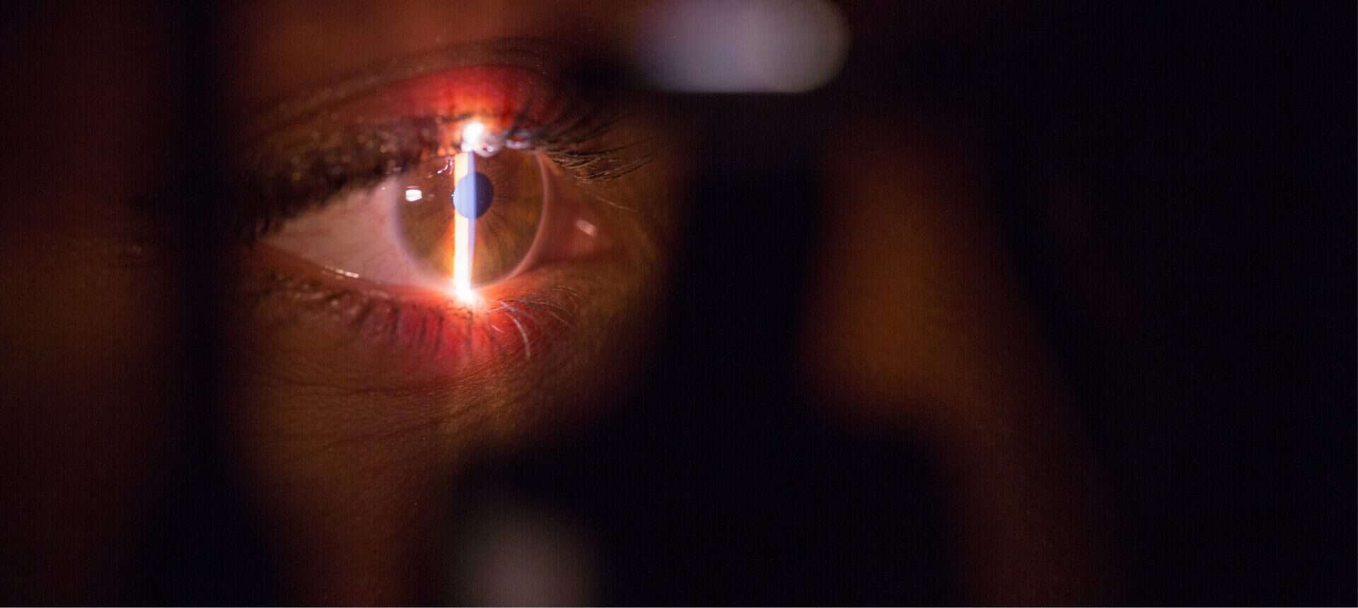A right eye being tested for vision and defects with light in a dark room
